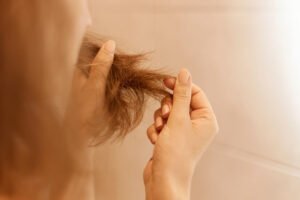 Does Prednisone Cause Hair Loss as a Side Effect?