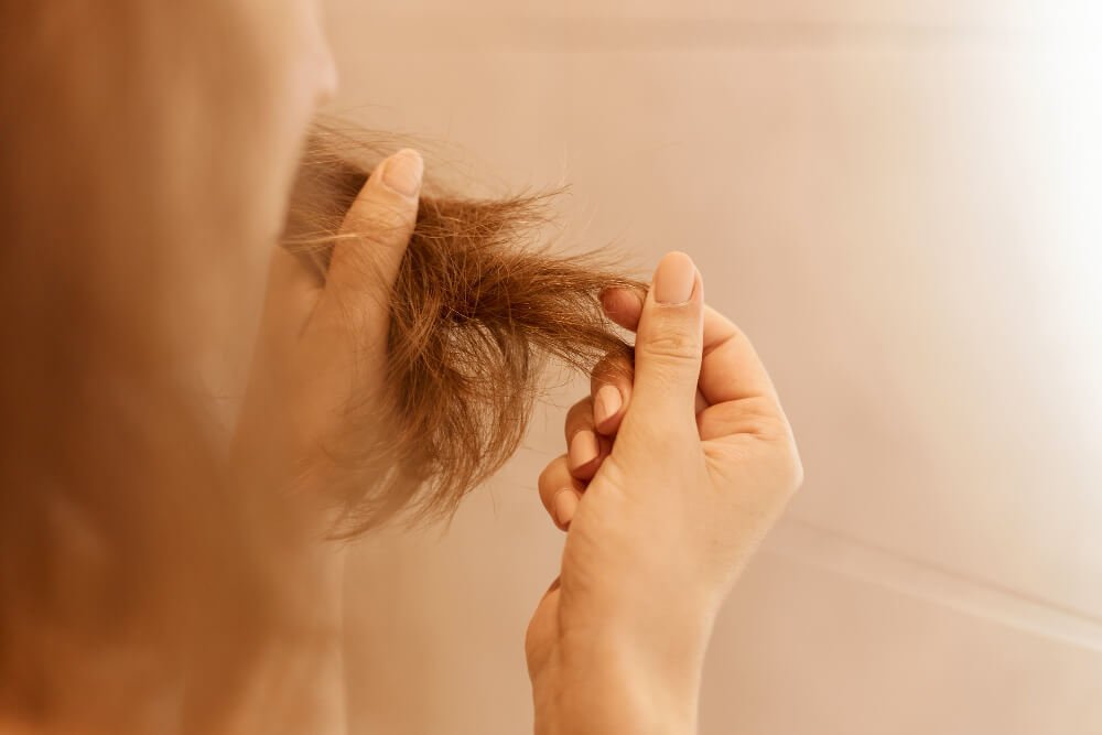 Does Prednisone Cause Hair Loss as a Side Effect?