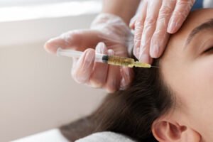What is Mesotherapy for Hair Loss